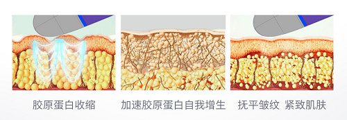 全方位解决护肤烦恼，美国西屋Venus多功效美容仪上市